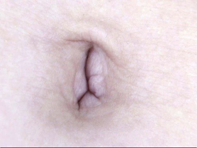 GA-314 Bagian 15 - 86 minit