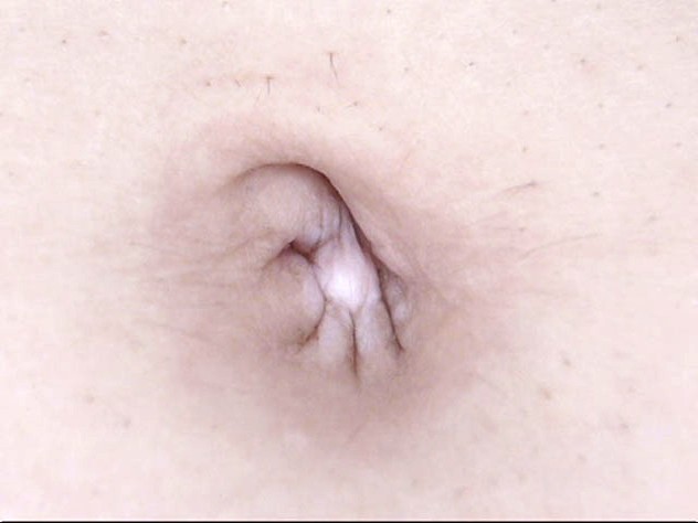 GA-314 Bagian 2 - 34 minit