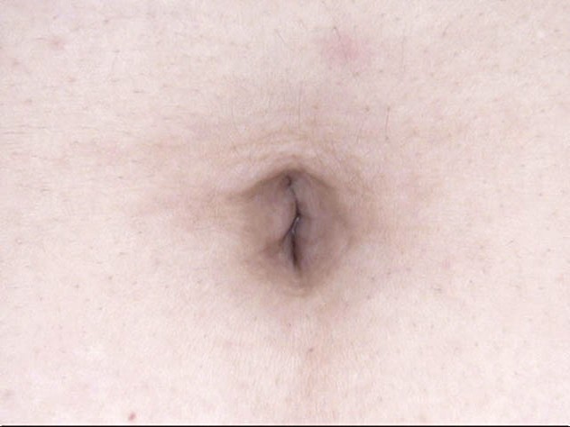 GA-314 Bagian 20 - 106 minit