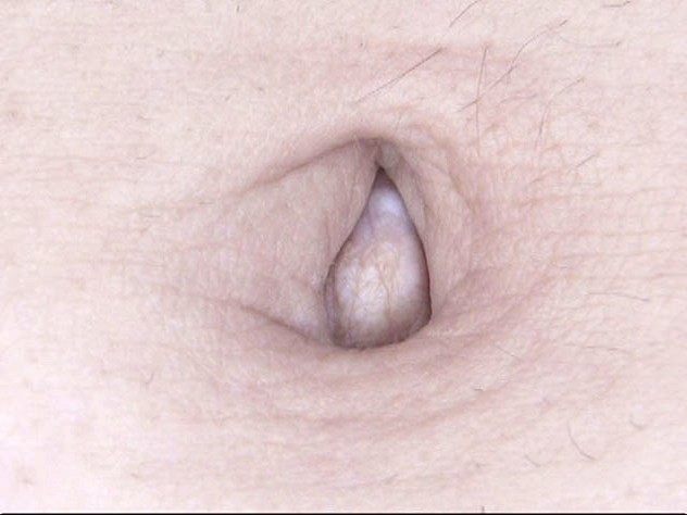 GA-314 Bagian 3 - 38 minit