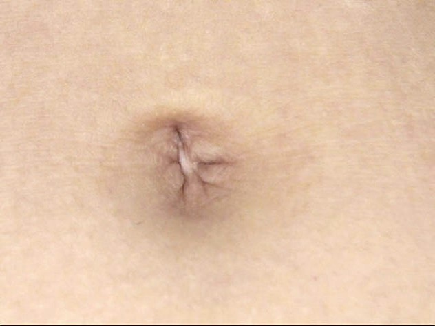 GA-314 Bagian 9 - 62 minit