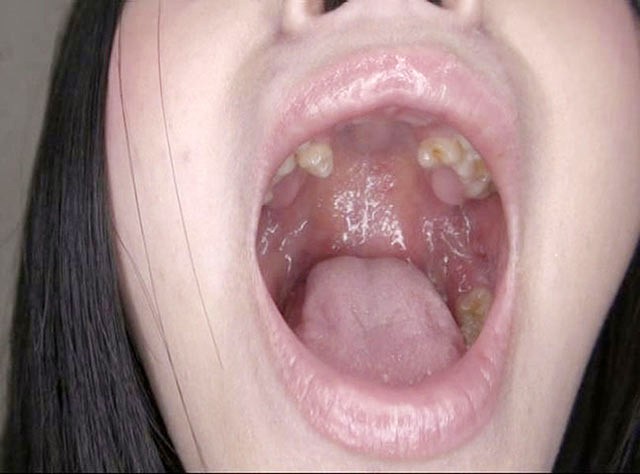 GA-320 Part 10 - 66 minutes