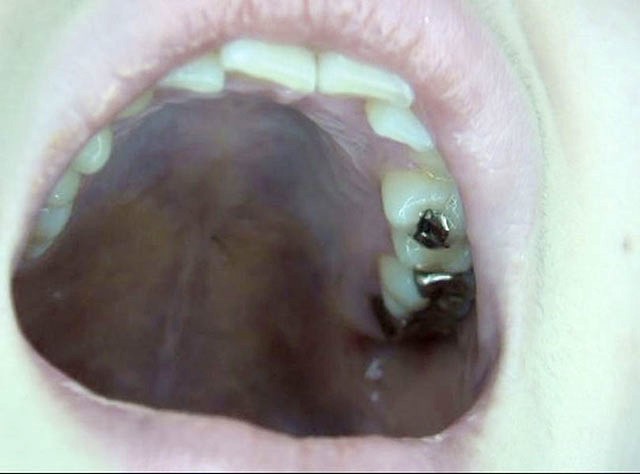 GA-320 Part 11 - 70 minutes