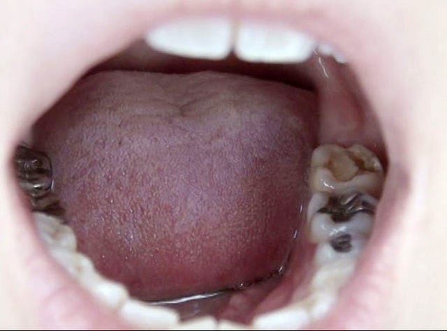 GA-320 Part 13 - 78 minutes