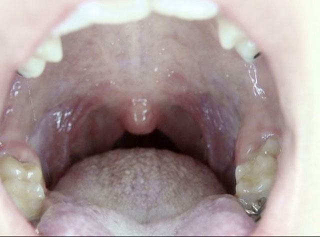 GA-320 Part 14 - 82 minutes