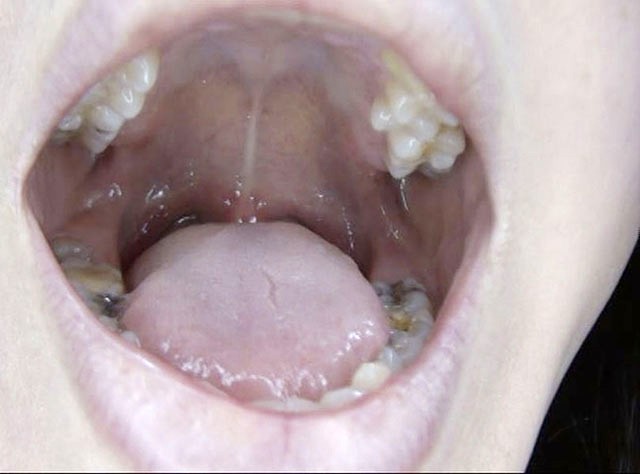 GA-320 Part 15 - 86 minutes