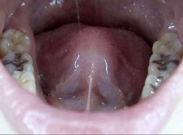 GA-320 Part 17 - 94 minutes