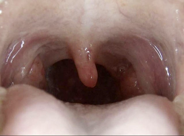 GA-320 Part 18 - 98 minutes