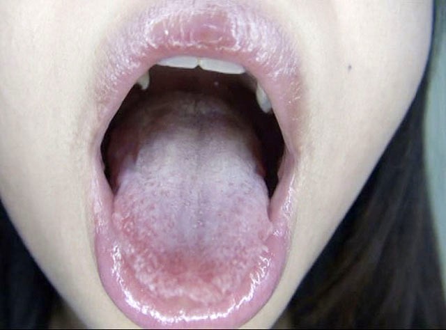 GA-320 Part 19 - 102 minutes