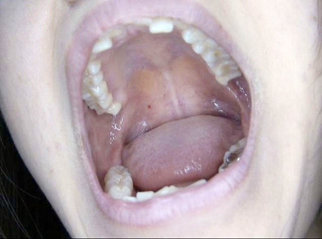 GA-320 Part 2 - 34 minutes