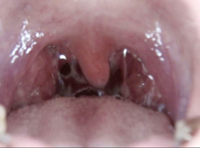 GA-320 Bagian 20 - 106 minit