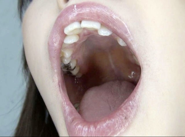 GA-320 Bagian 3 - 38 minit