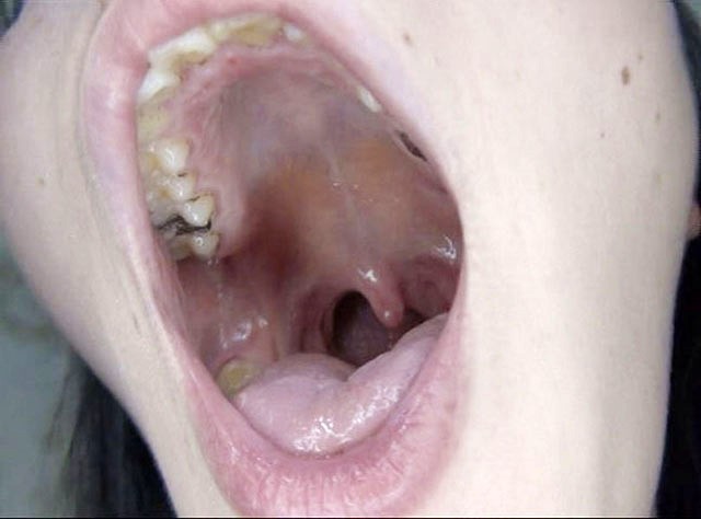 GA-320 Bagian 7 - 54 minit