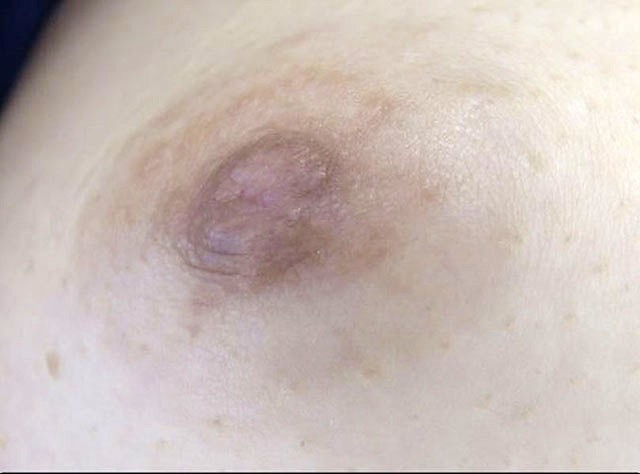 GA-321 パート 12 - 74 分