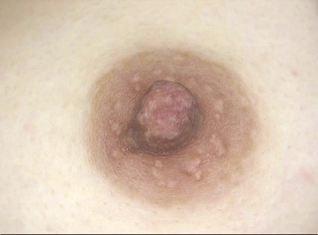 GA-321 パート 17 - 94 分