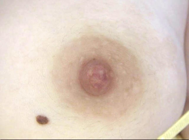 GA-321 第 19 部分 - 102 分钟