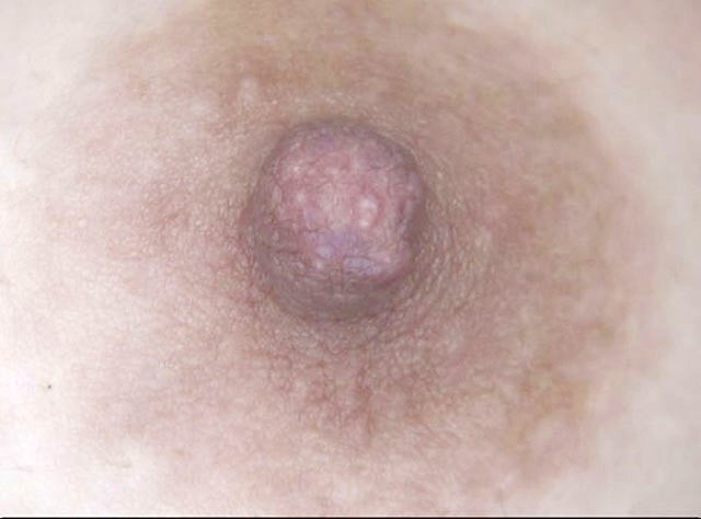 GA-321 第 3 部分 - 38 分钟