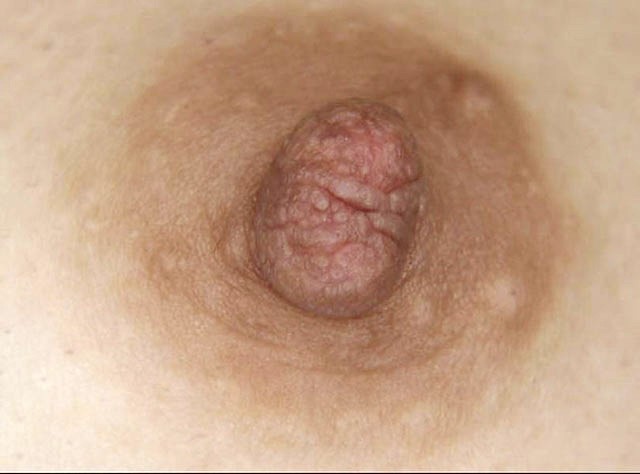 GA-327 Bagian 13 - 78 minit