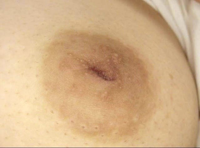 GA-327 Bagian 2 - 34 minit