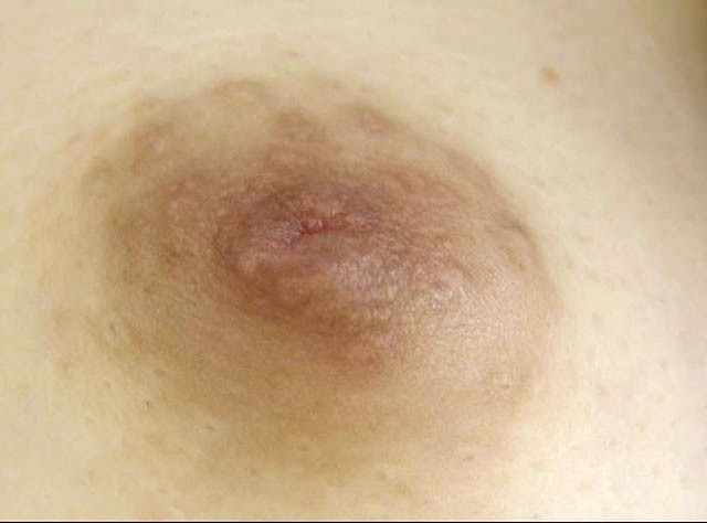 GA-327 Bagian 9 - 62 minit