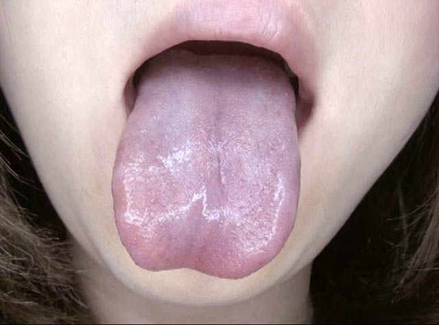 GA-330 Part 1 - 30 minutes