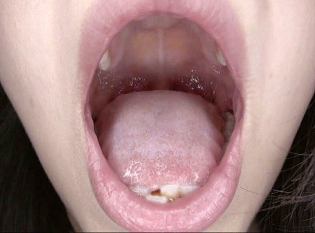 GA-330 Part 11 - 70 minutes