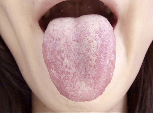 GA-330 Part 14 - 82 minutes