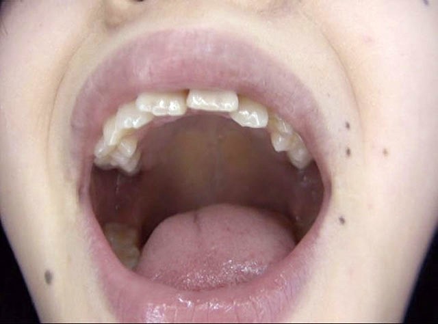 GA-330 Part 15 - 86 minutes