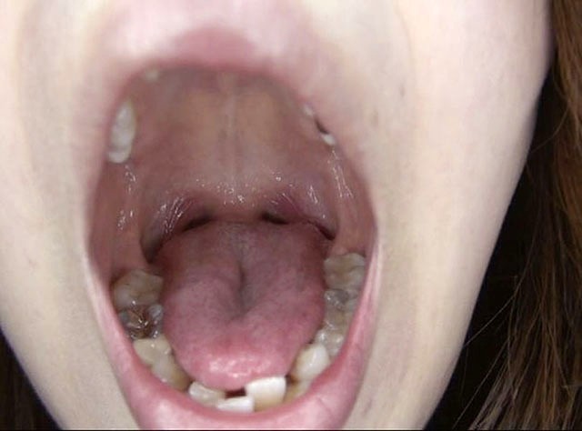 GA-330 パート 16 - 90 分