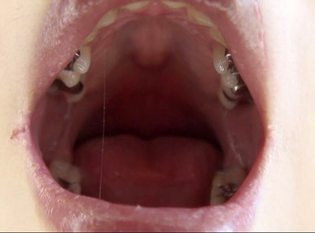 GA-330 Part 18 - 98 minutes