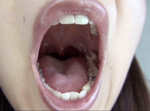 GA-330 Part 2 - 34 minutes