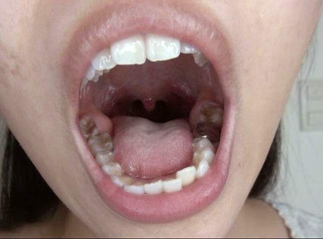 GA-330 Part 20 - 106 minutes