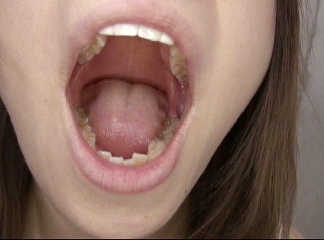 GA-330 Part 3 - 38 minutes