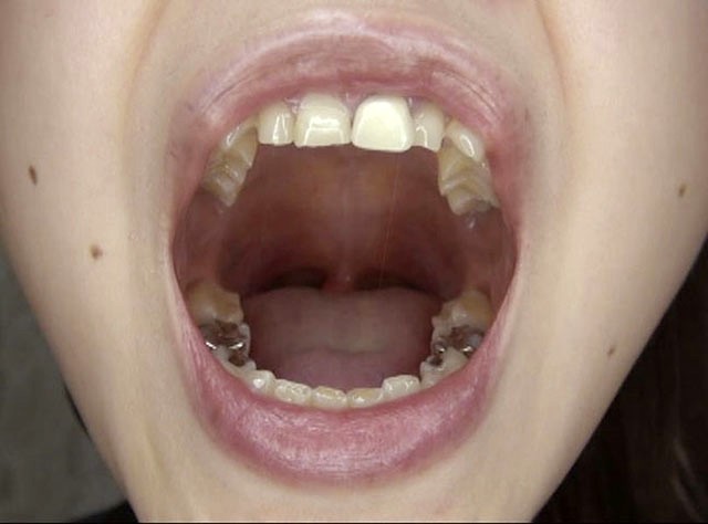 GA-330 Part 4 - 42 minutes