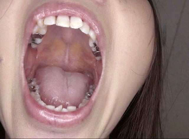 GA-330 パート 6 - 50 分