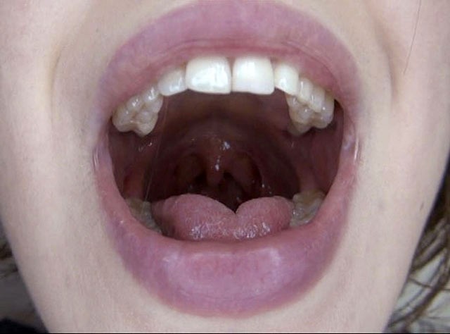 GA-330 Part 8 - 58 minutes