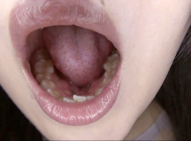 GA-330 Part 9 - 62 minutes