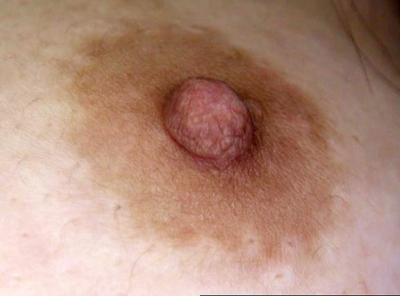 GA-334 第 13 部分 - 78 分钟