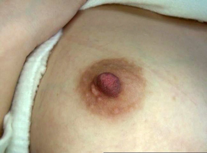 GA-334 第 2 部分 - 34 分钟