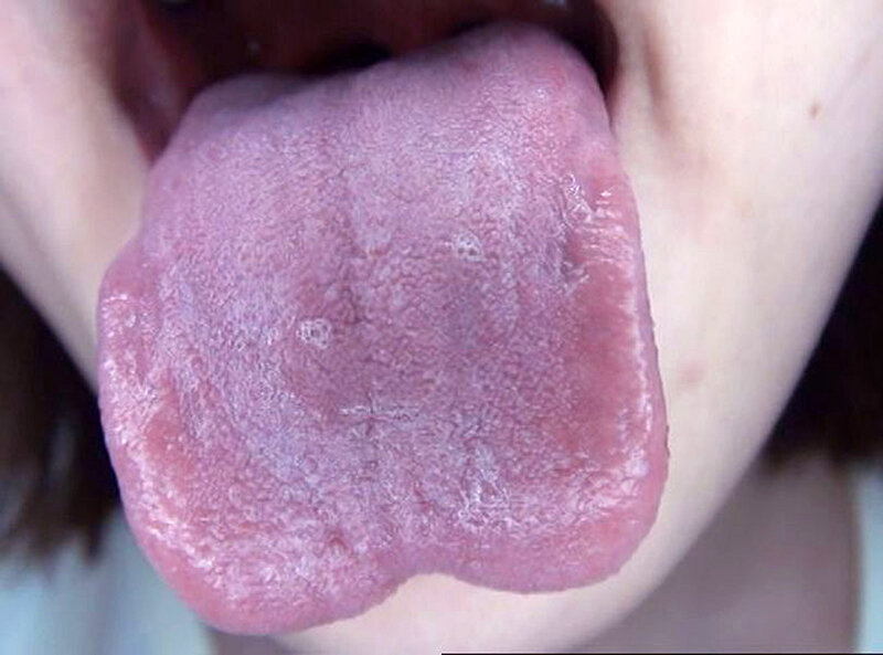 GA-336 Bagian 10 - 66 minit