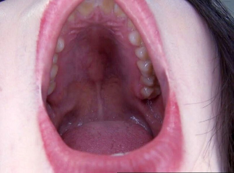 GA-336 Bagian 11 - 70 minit