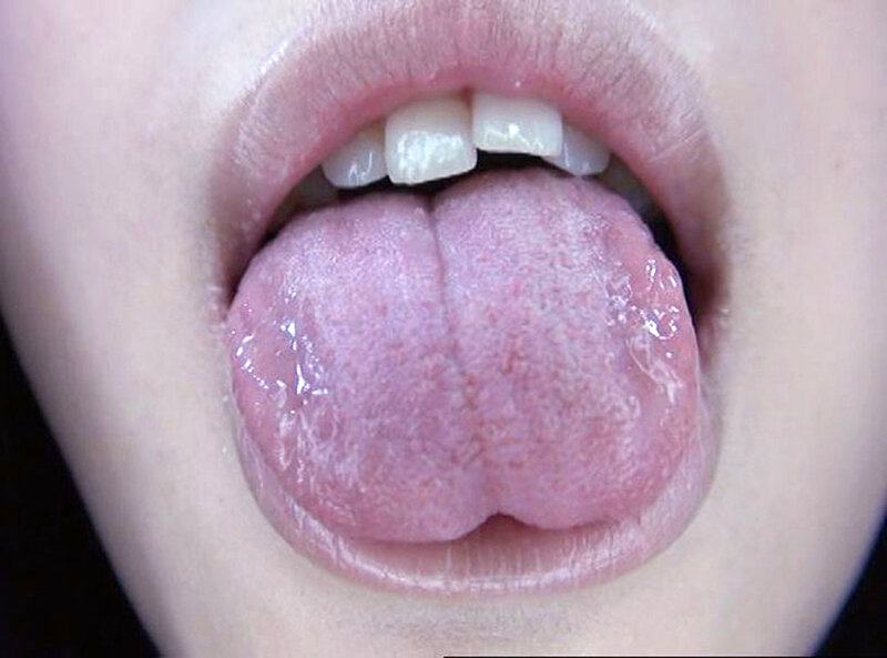 GA-336 Bagian 14 - 82 minit