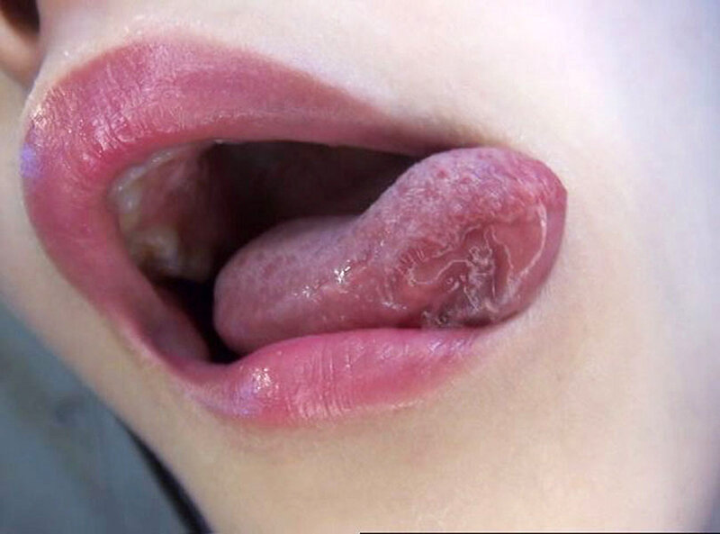 GA-336 Bagian 19 - 102 minit