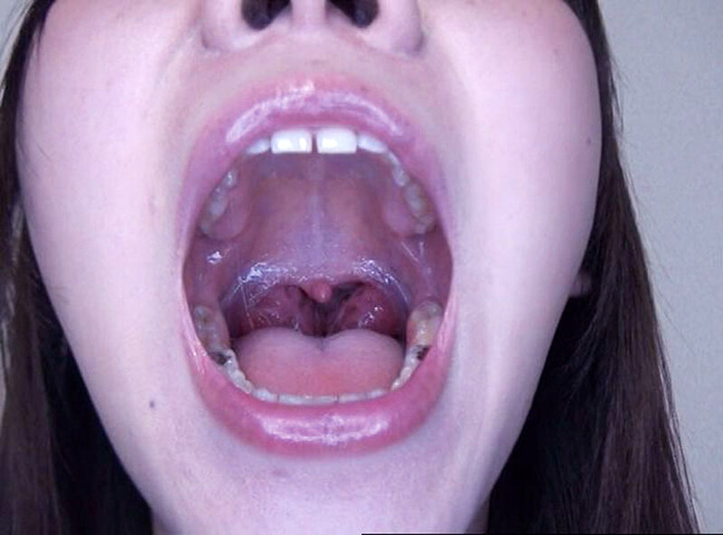 GA-336 Part 20 - 106 minutes