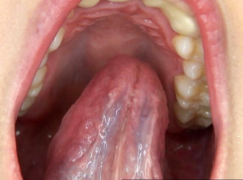 GA-336 Bagian 7 - 54 minit