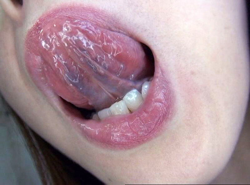 GA-336 Part 8 - 58 minutes