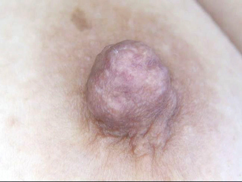 GA-341 Bagian 16 - 90 minit