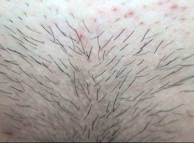 GA-343 パート 16 - 90 分