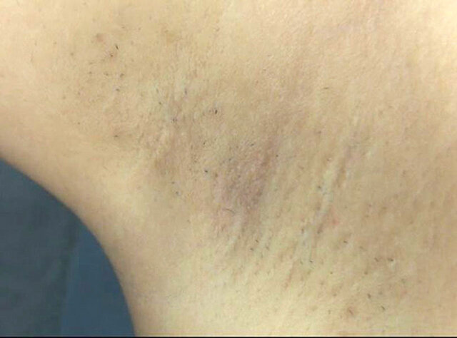 GA-347 第 1 部分 - 30 分钟