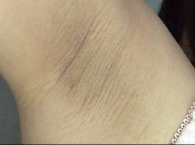 GA-347 Bagian 5 - 46 minit